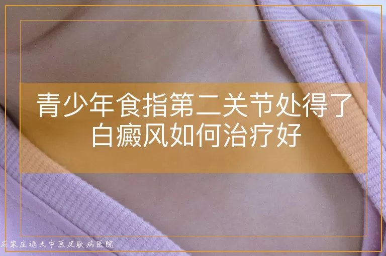青少年食指第二关节处得了白癜风如何治疗好