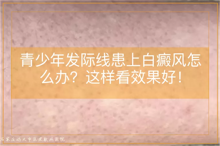 青少年发际线患上白癜风怎么办？这样看效果好！