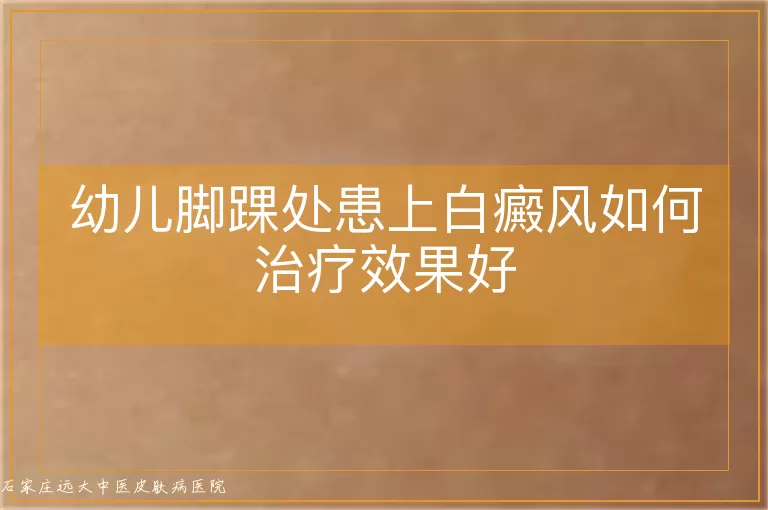幼儿脚踝处患上白癜风如何治疗效果好