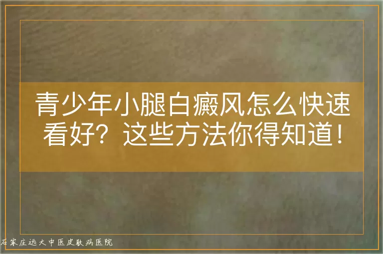 青少年小腿白癜风怎么快速看好？这些方法你得知道！