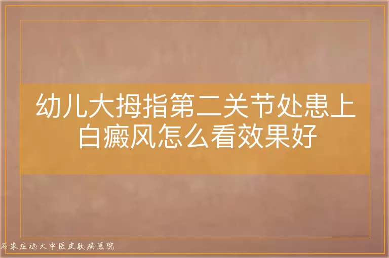 幼儿大拇指第二关节处患上白癜风怎么看效果好