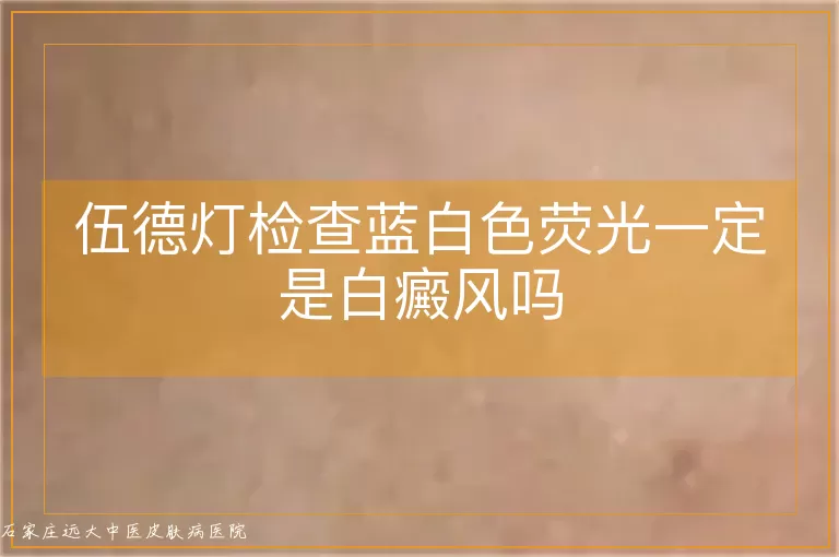 伍德灯检查蓝白色荧光一定是白癜风吗