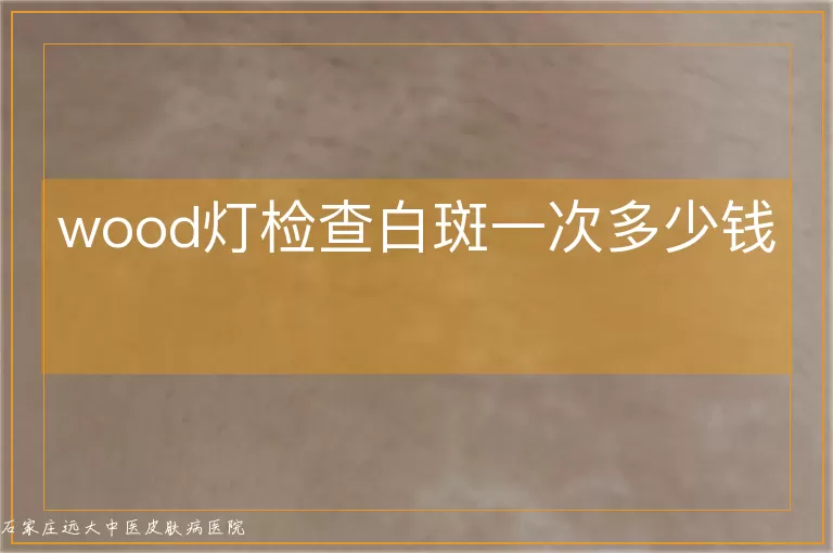 wood灯检查白斑一次多少钱
