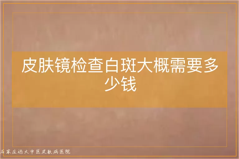 皮肤镜检查白斑大概需要多少钱