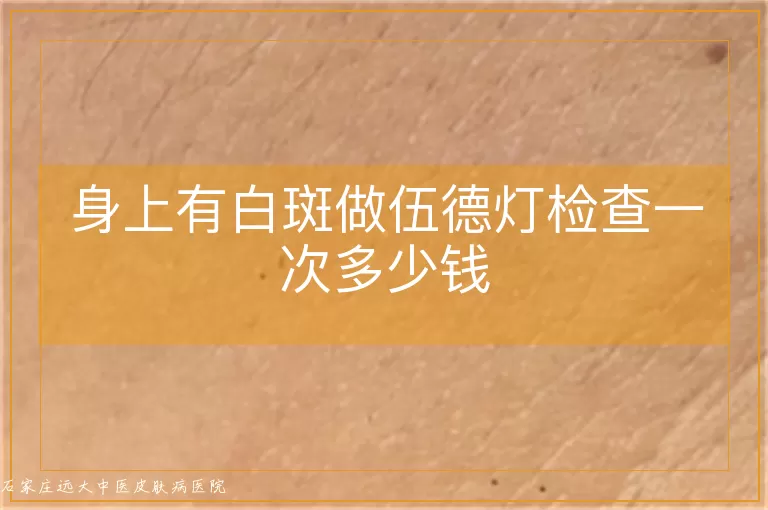 身上有白斑做伍德灯检查一次多少钱