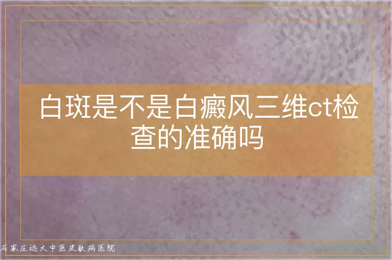 白斑是不是白癜风三维ct检查的准确吗