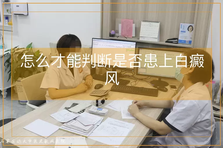 怎么才能判断是否患上白癜风
