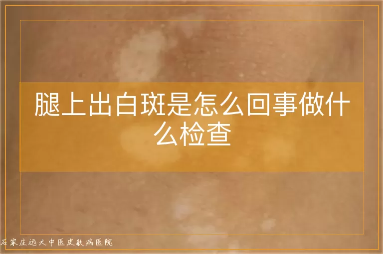 腿上出白斑是怎么回事做什么检查