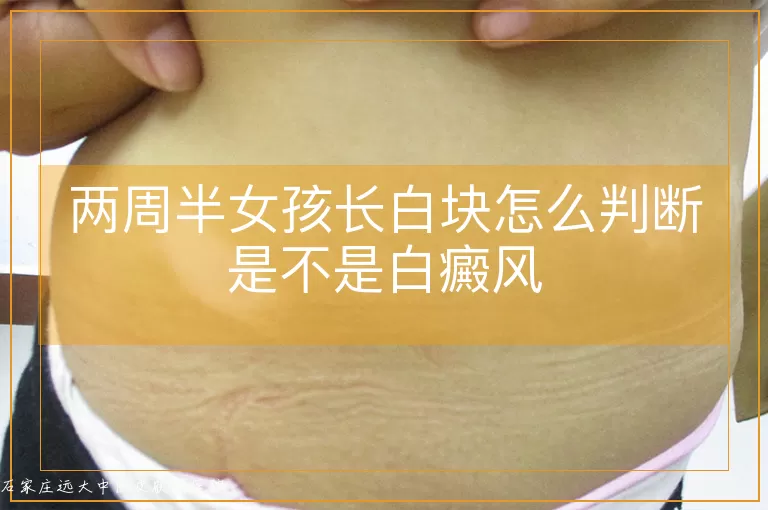 两周半女孩长白块怎么判断是不是白癜风