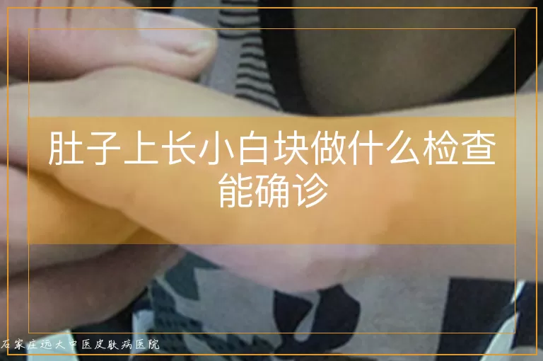 肚子上长小白块做什么检查能确诊