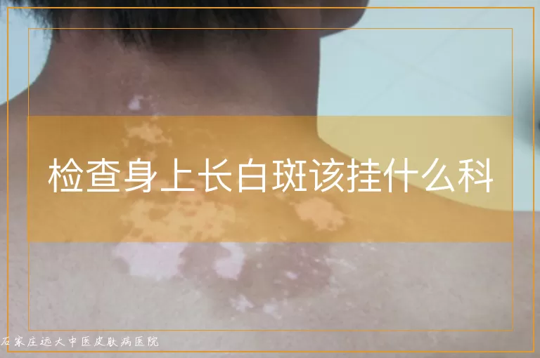 检查身上长白斑该挂什么科