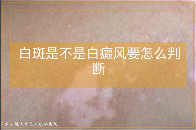 白斑是不是白癜风要怎么判断