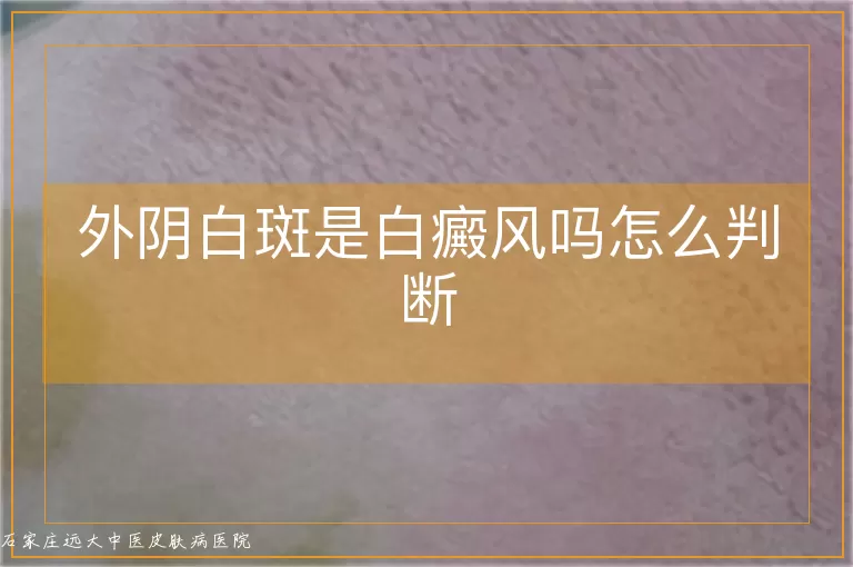 外阴白斑是白癜风吗怎么判断
