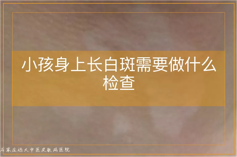 小孩身上长白斑需要做什么检查