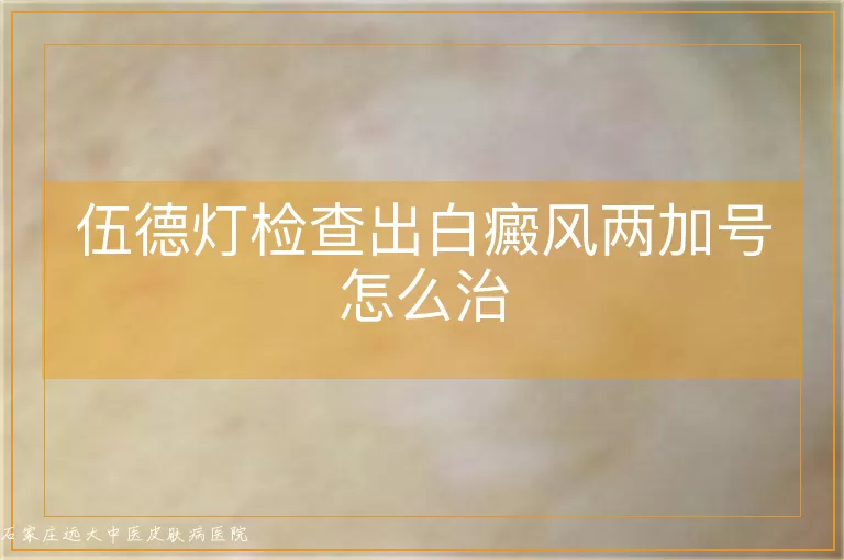 伍德灯检查出白癜风两加号怎么治