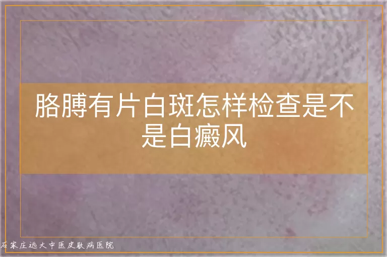 胳膊有片白斑怎样检查是不是白癜风