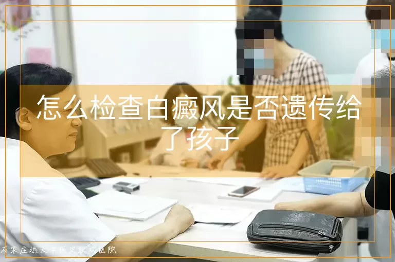 怎么检查白癜风是否遗传给了孩子