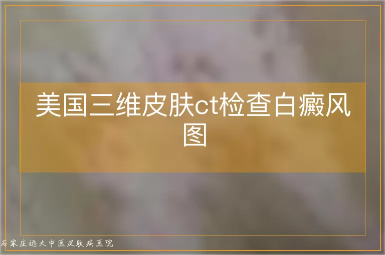 美国三维皮肤ct检查白癜风图