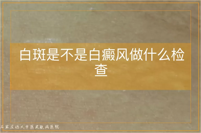 白斑是不是白癜风做什么检查