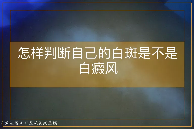 怎样判断自己的白斑是不是白癜风
