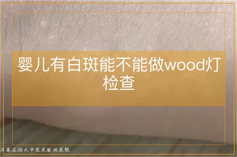 婴儿有白斑能不能做wood灯检查
