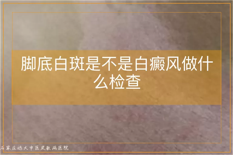 脚底白斑是不是白癜风做什么检查