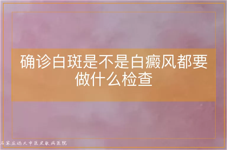 确诊白斑是不是白癜风都要做什么检查