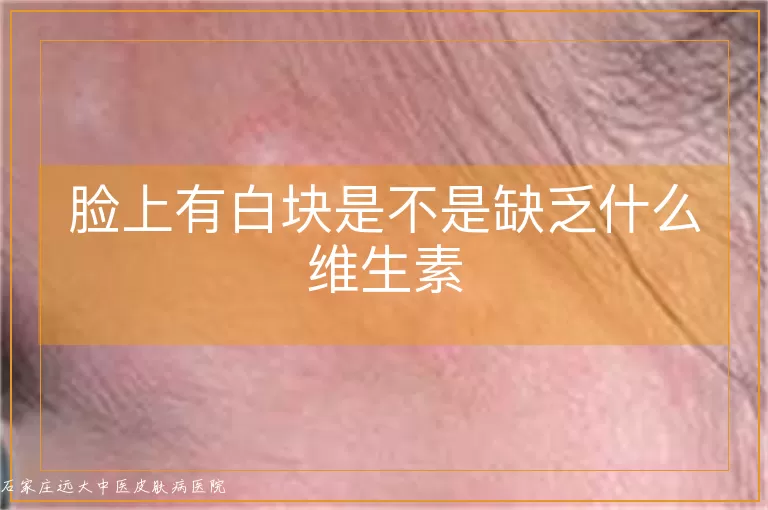 脸上有白块是不是缺乏什么维生素