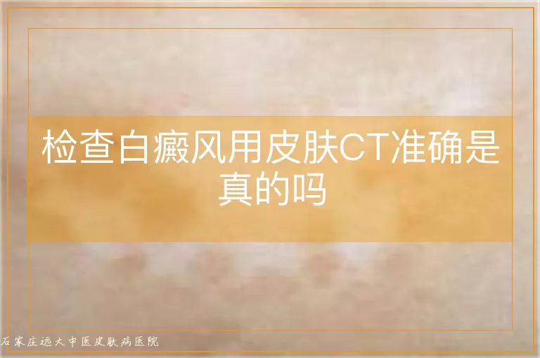 检查白癜风用皮肤CT准确是真的吗