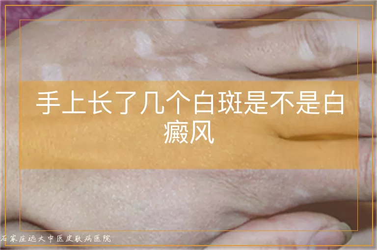 手上长了几个白斑是不是白癜风