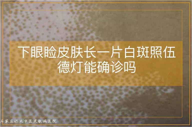 下眼睑皮肤长一片白斑照伍德灯能确诊吗