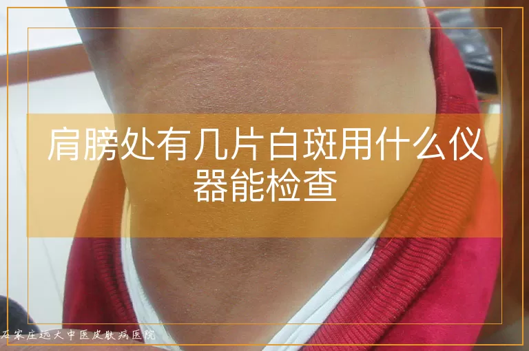 肩膀处有几片白斑用什么仪器能检查