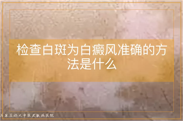 检查白斑为白癜风准确的方法是什么