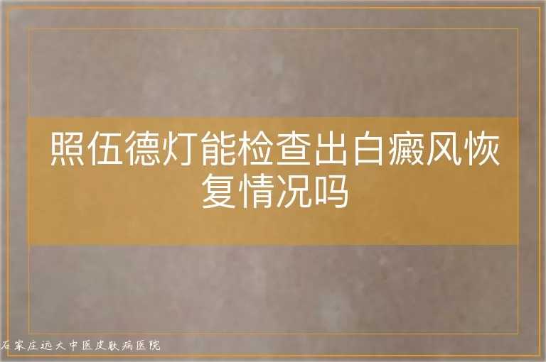 照伍德灯能检查出白癜风恢复情况吗