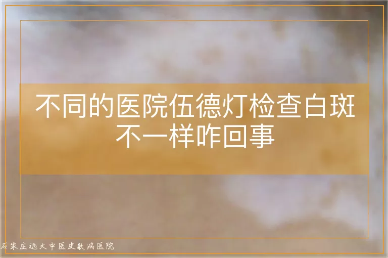 不同的医院伍德灯检查白斑不一样咋回事