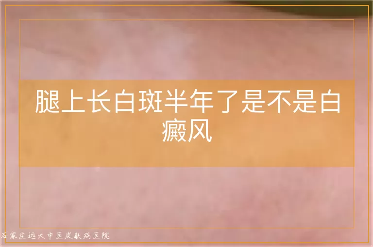 腿上长白斑半年了是不是白癜风