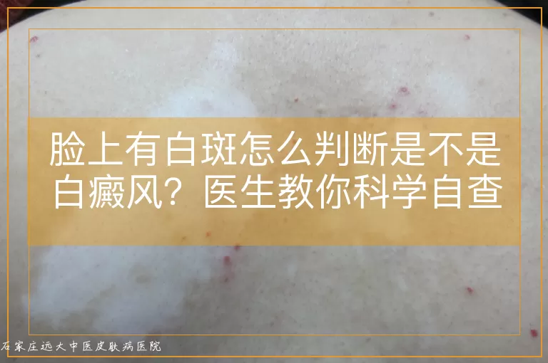 脸上有白斑怎么判断是不是白癜风？医生教你科学自查与就医