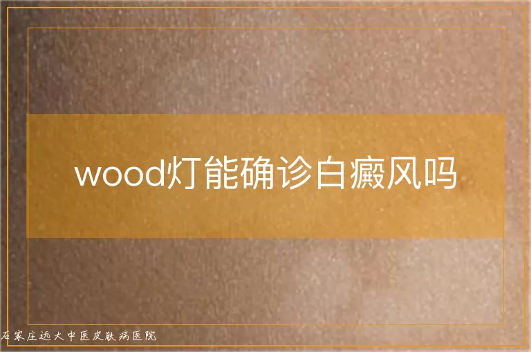 wood灯能确诊白癜风吗