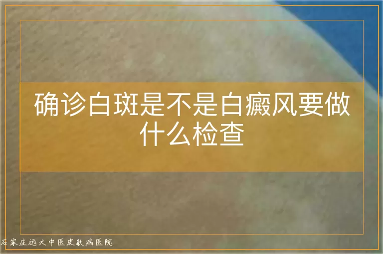 确诊白斑是不是白癜风要做什么检查