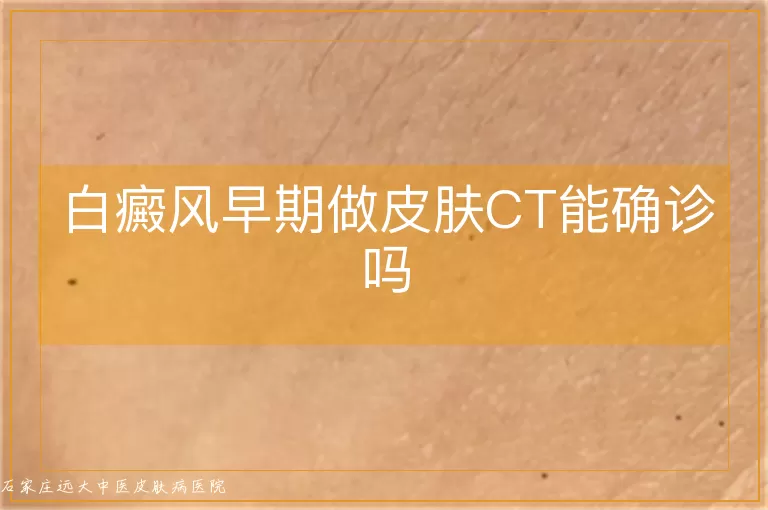 白癜风早期做皮肤CT能确诊吗
