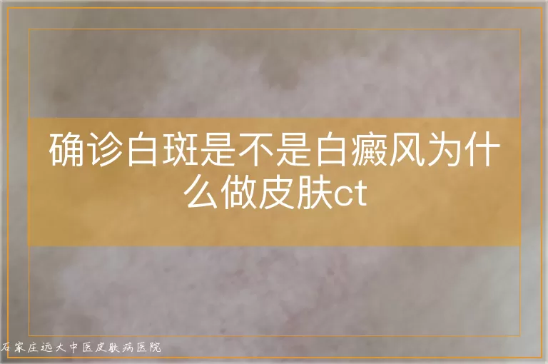 确诊白斑是不是白癜风为什么做皮肤ct