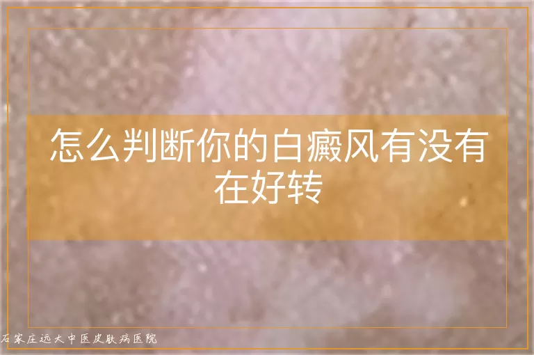 怎么判断你的白癜风有没有在好转