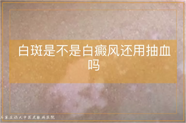 白斑是不是白癜风还用抽血吗