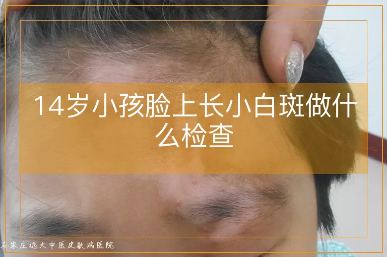 14岁小孩脸上长小白斑做什么检查