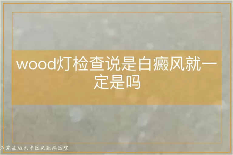 wood灯检查说是白癜风就一定是吗