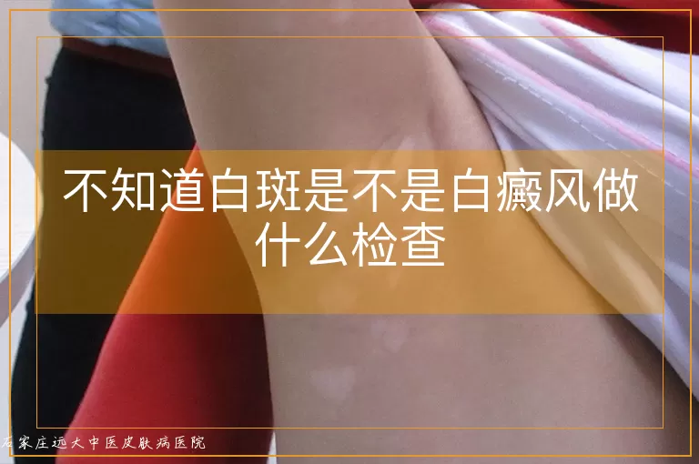 不知道白斑是不是白癜风做什么检查