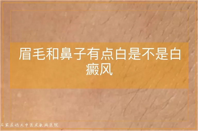 眉毛和鼻子有点白是不是白癜风