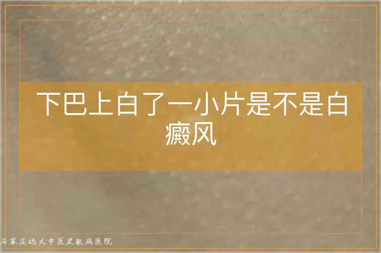 下巴上白了一小片是不是白癜风