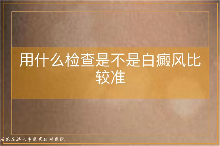 用什么检查是不是白癜风比较准