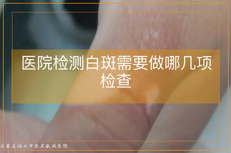 医院检测白斑需要做哪几项检查